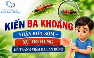 Kiến ba khoang: Nhận biết sớm – xử trí đúng để tránh viêm da lan rộng